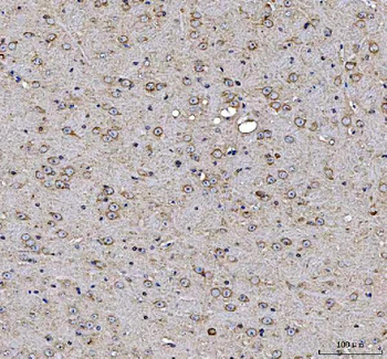 Anti-MAP1S Antibody