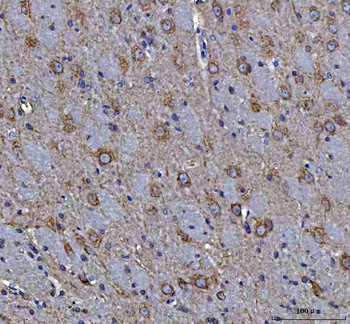 Anti-MAP1S Antibody