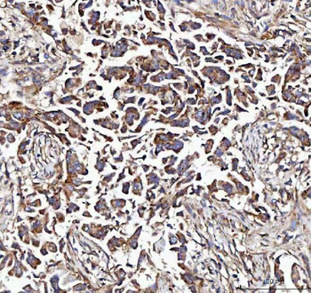 Anti-MCCC2 Antibody