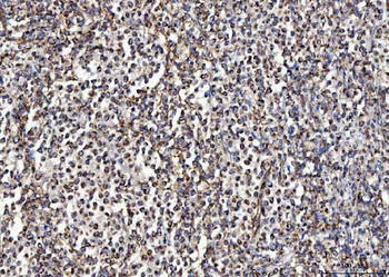 Anti-MCCC2 Antibody