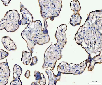 Anti-MCCC2 Antibody