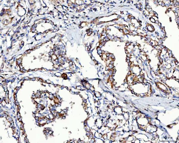 Anti-MCCC2 Antibody