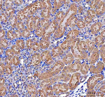 Anti-MCCC2 Antibody