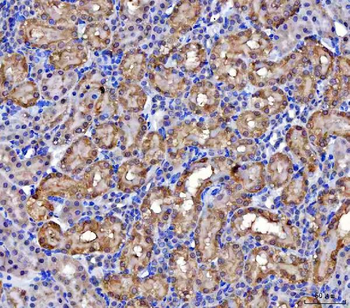 Anti-MCCC2 Antibody