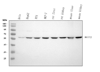 Anti-MCCC2 Antibody