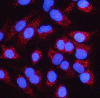 Anti-MCCC1 Antibody