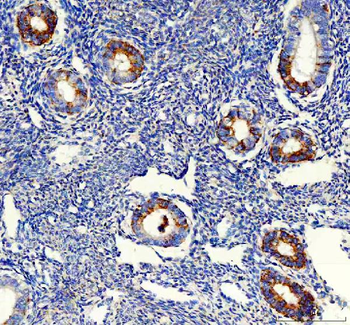 Anti-MCCC1 Antibody