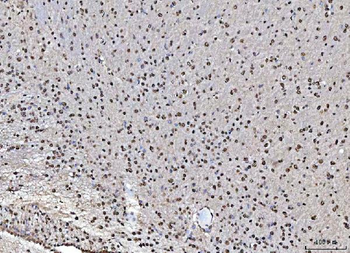 Anti-MATR3 Antibody