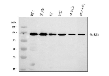 Anti-MATR3 Antibody