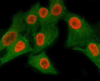 Anti-MATR3 Antibody