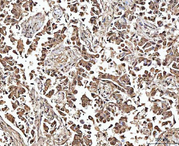 Anti-MATR3 Antibody