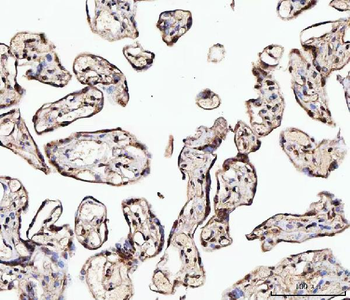 Anti-MATR3 Antibody