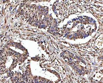 Anti-MATR3 Antibody