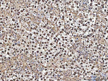 Anti-MATR3 Antibody