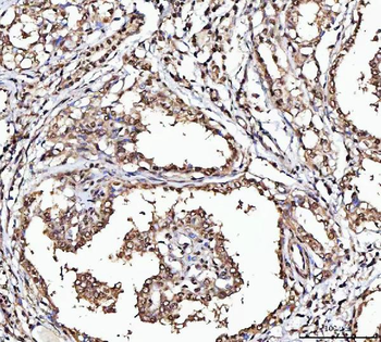 Anti-MATR3 Antibody