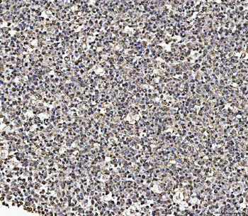 Anti-MATR3 Antibody