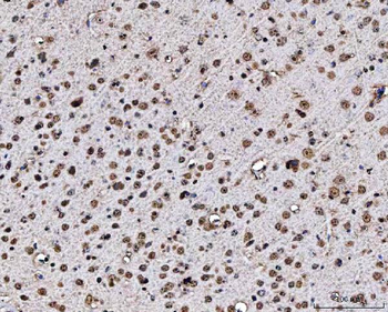 Anti-MATR3 Antibody