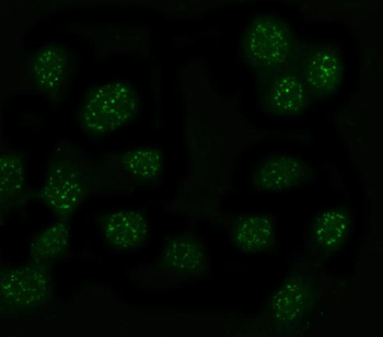 Anti-MYT1L Antibody