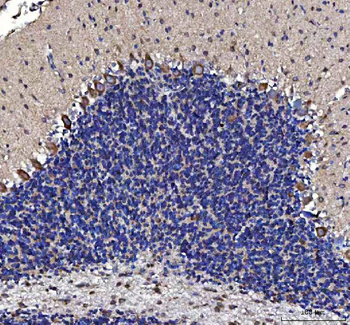 Anti-MTCL1 Antibody