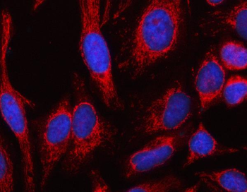 Anti-MSLNL Antibody