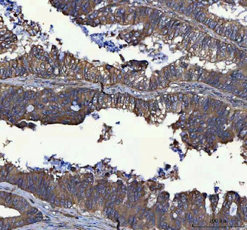 Anti-MSLNL Antibody