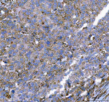 Anti-Malectin/MLEC Antibody