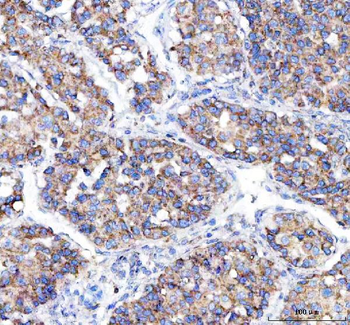 Anti-Malectin/MLEC Antibody