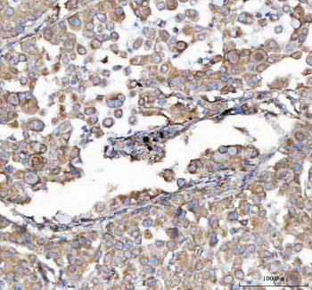 Anti-Malectin/MLEC Antibody