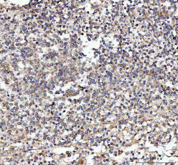 Anti-Malectin/MLEC Antibody