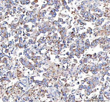 Anti-Malectin/MLEC Antibody