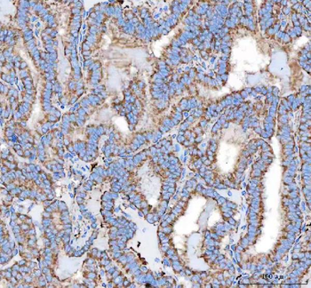 Anti-Malectin/MLEC Antibody