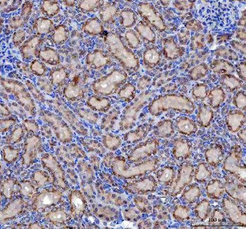 Anti-Malectin/MLEC Antibody