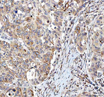 Anti-L3MBTL3 Antibody