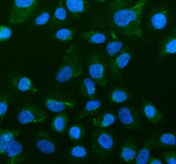 Anti-MAP6D1 Antibody