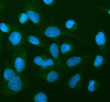 Anti-MAP6D1 Antibody