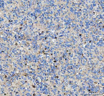 Anti-MAP6D1 Antibody