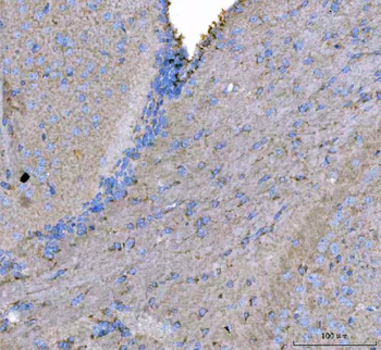 Anti-MAP6D1 Antibody
