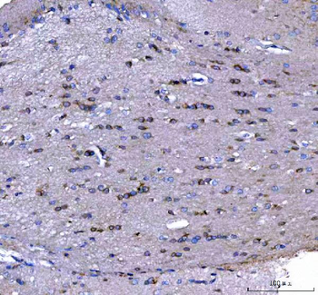 Anti-MAP6D1 Antibody