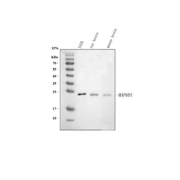 Anti-MAP6D1 Antibody