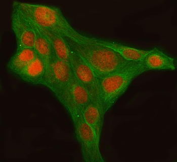 LHX6 Antibody