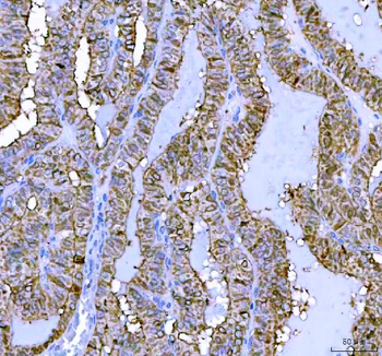 Anti-LHX6 Antibody