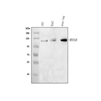 Anti-MYO1B Antibody