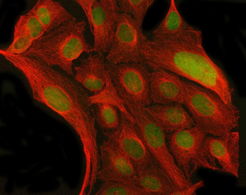 Anti-MYNN Antibody