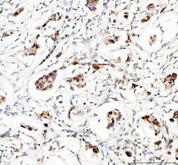 Anti-MYNN Antibody