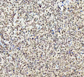 Anti-MYNN Antibody