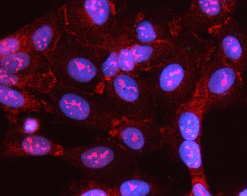 Anti-MYL5 Antibody