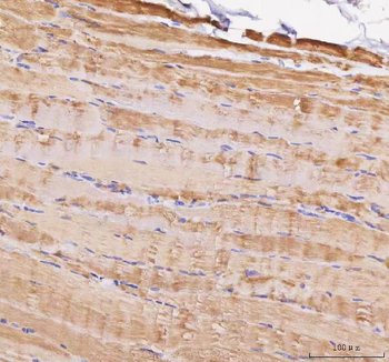 Anti-MYL5 Antibody