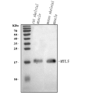 Anti-MYL5 Antibody