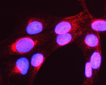 MYH16 Rabbit Polyclonal Antibody