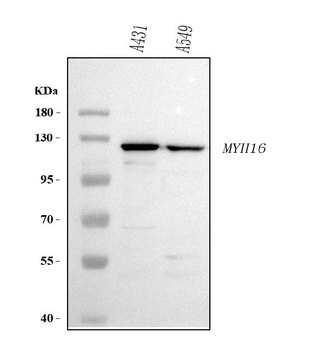 MYH16 Rabbit Polyclonal Antibody